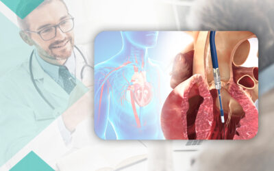 خاص لأطباء القلب: سلسلة فيديوهات جديدة خاصّة بالتحضيرات اللازمة لجراحة صمّام القلب
